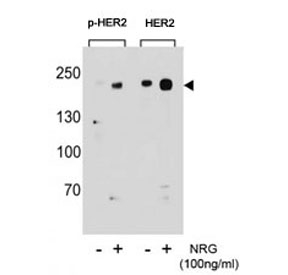 Western blot analysis of extracts from T47D cells, untreated or treated with NRG, using p-HER2 antibody (left) or nonphos Ab (right).~