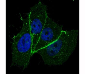 Fluorescent confocal image of MCF7 cells stained with phospho-ERBB2 antibody at 1:100. Note the highly specific localization of ERBB2 to the plasma membrane.~