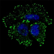 Fluorescent confocal image of MCF7 cells stained with phos-ERBB2 antibody at 1;100. Note the highly specific localization to the plasma membrane and cytoplasm.