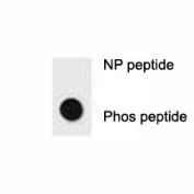 Dot blot analysis of p-ERBB2 antibody. 50ng of phos-peptide or nonphos-peptide per dot were spotted.