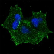 Fluorescent confocal image of MCF7 cells stained with p-ERBB2 antibody. MCF7 cells were fixed with 4% PFA (20 min), permeabilized with Triton X-100 (0.2%, 30 min). Cells were then incubated with primary Ab (1:100, 2 h at room temperature). For secondary Ab, Alexa Fluor 488 conjugated donkey anti-rabbit Ab (green) was used (1:1000, 1h). Nuclei were counterstained with Hoechst 33342 (blue) (10 ug/ml, 5 min). Note the highly specific localization to the plasma membrane and cytoplasm.