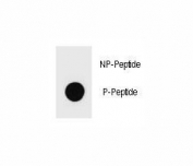 Dot blot analysis of phospho-Kit antibody. 50ng of phos-peptide or nonphos-peptide per dot were spotted.