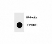 Dot blot analysis of phospho-c-Kit antibody. 50ng of phos-peptide or nonphos-peptide per dot were spotted.