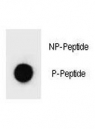 Dot blot analysis of p-PARP1 antibody. 50ng of phos-peptide or nonphos-peptide per dot were spotted.
