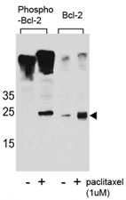 Western blot analysis of extracts from Jurkat cells, untreated or treated with Paclitaxel, using phospho Bcl-2 antibody (left) or nonphos Ab (right).~