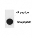 Dot blot analysis of p-p62 antibody. 50ng of phos-peptide or nonphos-peptide per dot were spotted.