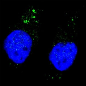 Fluorescent image of Chloroquine treated U251 cells stained with phospho-ULK1 antibody at 1:200. Immunoreactivity is localized to autophagic vacuoles in the cytoplasm.~