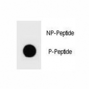 Dot blot analysis of phospho-TSC2 antibody. 50ng of phos-peptide or nonphos-peptide per dot were spotted.