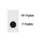 Dot blot analysis of phospho-TSC2 antibody. 50ng of phos-peptide or nonphos-peptide per dot were spotted.