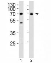 Western blot analysis of lysate from 1) Jurkat and 2) SK-BR-3 cell line using CD46 antibody at 1:1000. Observed molecular weight: 41~70 kDa depending on glycosylation level.
