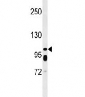 Western blot analysis of ABCC11 antibody and WiDr lysate. Predicted molecular weight: ~154/150kDa (isoforms 1/2).