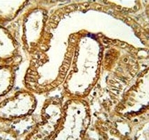 CCR1 antibody immunohistochemistry analysis in formalin fixed and paraffin embedded human kidney tissue.