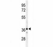Western blot analysis of CCR1 antibody and 293 lysate. Predicted size 40-45 kDa