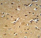 CD30 antibody immunohistochemistry analysis in formalin fixed and paraffin embedded human brain tissue.