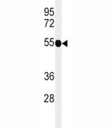 Western blot analysis of CD30 antibody and mouse liver tissue lysate. Predicted molecular weight: 53-120 kDa depending on glycosylation level.~