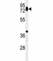 Western blot analysis of HAS1 antibody in ZR-75-1 lysate.
