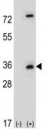 Western blot analysis of Caspase-3 antibody and 293 cell lysate (2 ug/lane) either nontransfected (Lane 1) or transiently transfected (2) with the CASP3 gene.