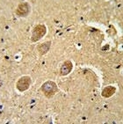 Caspase-3 antibody IHC analysis in formalin fixed and paraffin embedded human brain tissue.