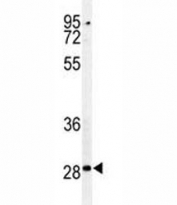 Caspase-3 antibody WB and CEM lysate.  Expected size ~32 KDa