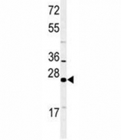 Western blot analysis of RAB27B antibody and NCI-H460 lysate.