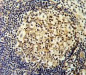 CCR7 antibody IHC analysis in formalin fixed and paraffin embedded human tonsil.