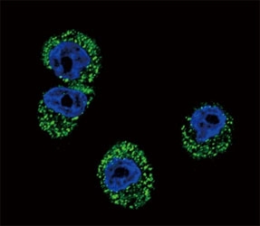 Confocal immunofluorescent analysis of CCR7 antibody with MDA-MB231 cells followed by Alexa Fluor 488-conjugated goat anti-rabbit lgG (green). DAPI was used as a nuclear counterstain (blue).