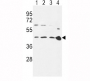 CCR7 antibody western blot analysis in 293 (lane 1), Ramos (2), MDA-MB231 (3) cell line and mouse spleen tissue (4) lysate. Predicted size ~45 kDa