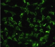 Immunofluorescence analysis of CA9 antibody with HeLa cells. Primary Ab was followed by FITC-conjugated goat anti-rabbit lgG; FITC emits green fluorescence.