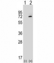 Western blot analysis of XRCC6 antibody and 293 cell lysate either nontransfected (Lane 1) or transiently transfected (2) with the XRCC6 gene.