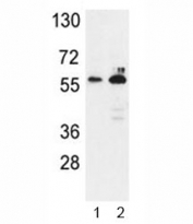 Western blot analysis of G6PD antibody and 1) K562, 2) MCF-7 lysate. Predicted molecular weight ~59 kDa.