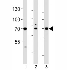 Western blot analysis of lysate from (1) HeLa, (2) HepG2 and (3) human placenta tissue lysate using ATF6 beta antibody at 1:1000.