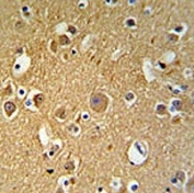 TUBB2C antibody IHC analysis in formalin fixed and paraffin embedded human brain tissue