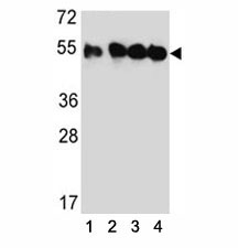 Western blot analysis of TUBB2C antibody and (1) HeLa, (2) MDA-MB435, (3) MDA-MB231, and (4) HepG2 lysate.~