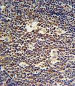 IL-4 antibody IHC analysis in formalin fixed and paraffin embedded tonsil