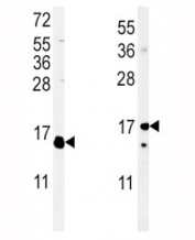 (Left) Western blot analysis of IL-4 antibody and WiDr lysate; (Right) Western blot analysis of IL-4 antibody and mouse cerebellum lysate. Expected molecular weight: 14-20 kDa depending on glycosylation level.