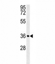 Cyclin D antibody western blot analysis in HepG2 lysate. Predicted molecular weight: 32-36 kDa.
