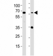 Western blot testing of CD63 antibody at 1:1000 dilution. Lane 1: A2058 lysate; 2: MDA-MB-453 lysate; Predicted molecular weight: 25-60 kDa depending on glycosylation level.