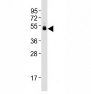 Western blot testing of CD63 antibody at 1:1000 dilution + human plasma lysate; Predicted molecular weight: 25-60 kDa depending on glycosylation level.