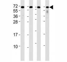 Western blot testing of CD63 antibody at 1:2000 dilution. Lane 1: A2058 lysate; 2: A375 lysate; 3: THP-1 lysate; 4: U-87 MG lysate; Predicted band size: 25-60 kDa depending on glycosylation level.