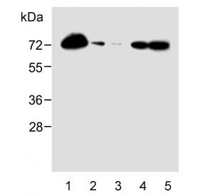 Western blot testing of human 1) HL-60, 2) U-251 MG, 3) THP-1, 4) A2058 and 5) A375 lysate with CD63 antibody. Predicted molecular weight: 25-60 kDa depending on glycosylation level.