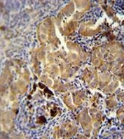 IHC testing of FFPE human skin with CD63 antibody at 1:25 dilution. HIER: steam tissue sections in 10mM citrate buffer, pH 6, for 10-20 min followed by cooling at RT for 20 min.