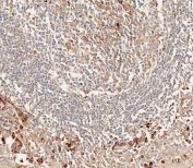 IHC testing of FFPE human tonsil tissue with CD63 antibody. HIER: steam tissue sections in 10mM citrate buffer, pH 6, for 10-20 min followed by cooling at RT for 20 min.