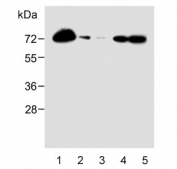 Western blot testing of human 1) HL-60, 2) U-251 MG, 3) THP-1, 4) A2058 and 5) A375 lysate with CD63 antibody. Predicted molecular weight: 25-60 kDa depending on glycosylation level.