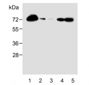 Western blot testing of human 1) HL-60, 2) U-251 MG, 3) THP-1, 4) A2058 and 5) A375 lysate with CD63 antibody. Predicted molecular weight: 25-60 kDa depending on glycosylation level.