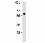 Western blot testing of human lung lysate with SMAD6 antibody. Observed molecular weight: 50~60 kDa.