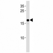HMGA2 antibody western blot analysis in HepG2 lysate. Predicted molecular weight ~12kDa but routinely observed at ~18kDa.