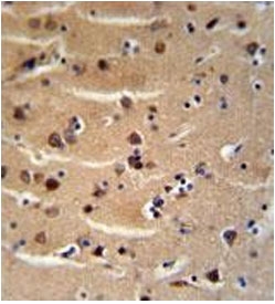 AXIN2 antibody immunohistochemistry analysis in formalin fixed and paraffin embedded human brain tissue