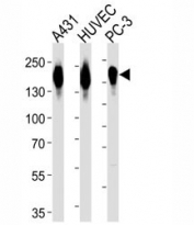 Western blot analysis of lysate from A431, HUVEC, PC3 cell line (left to right) using anti-EGFR antibody diluted at 1:1000 for each lane.