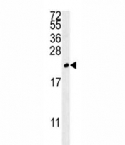 TREM2 antibody western blot analysis in MDA-MB435 lysate. Predicted molecular weight ~25kDa.