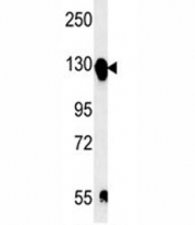 Integrin alpha 5 antibody western blot analysis in mouse bladder tissue lysate.